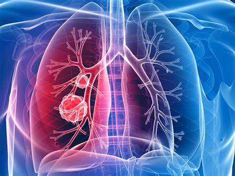 Dacomitinib API for NSCLC treatment