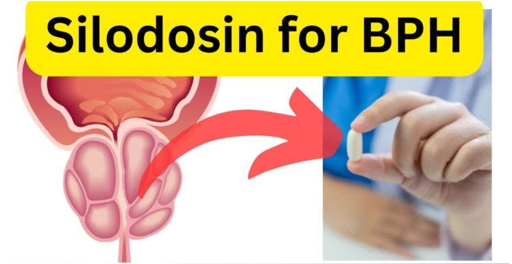 Silodosin for BPH